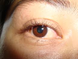 retina